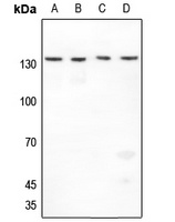 Histone Deacetylase 4 antibody