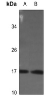 Histone H3 (phospho-S28) antibody