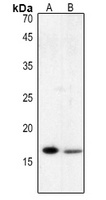 Histone H3 (AcK123) antibody