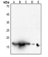 Histone H3 (AcK18) antibody