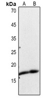 Histone H3 (AcK23) antibody