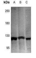 Hexokinase 1 antibody