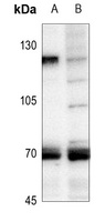 Anti-HSF1 Antibody