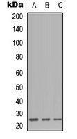 Anti-CD179b Antibody