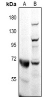 CD218b antibody