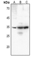 CD25 antibody