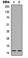 Anti-IL-1F5 Antibody