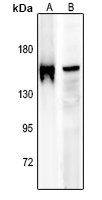 IRS1 (phospho-S636) antibody