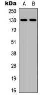 Anti-JMY Antibody