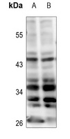 Kir6.2 antibody