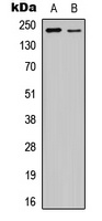 VEGFR2 (phospho-Y1175) antibody