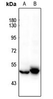 Cytokeratin 20 antibody