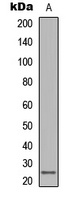 LT beta antibody