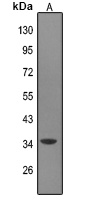 Anti-MAGEA9 Antibody