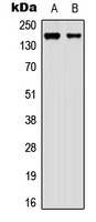 Anti-AIP-1 Antibody