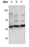 Tau antibody