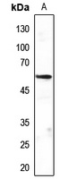 Anti-MEF2C Antibody