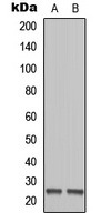 MOB1B antibody