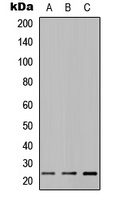 Anti-MUC16 Antibody