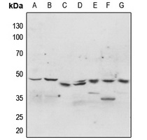 p47 phox (phospho-S304) antibody