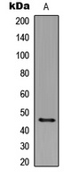 Anti-p47 phox (Phospho-S359) Antibody