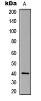 Anti-p40 phox Antibody