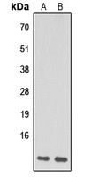 Anti-NDUFA1 Antibody