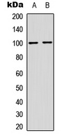 NF-kappaB p100 (phospho-S865) antibody