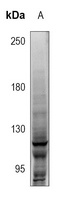 NOTCH1 antibody