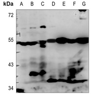 Anti-NPDC1 Antibody
