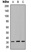 NRIP2 antibody