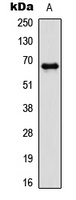 Anti-PAK1 (Phospho-T212) Antibody