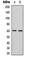 Anti-PDCD4 (Phospho-S457) Antibody
