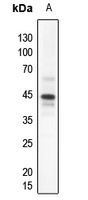 Anti-PDHA1 Antibody
