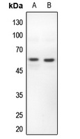 Anti-PFKFB2 Antibody