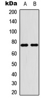 Anti-PIAS4 Antibody