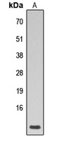 Phospholamban (phospho-S16/T17) antibody