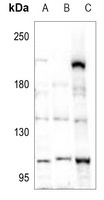 Anti-POM121 Antibody