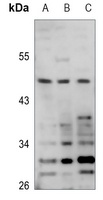 Anti-POTEA Antibody