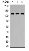 Anti-PPP1R13B Antibody
