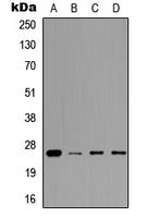 Prolactin antibody