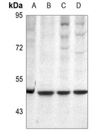 Protein C antibody