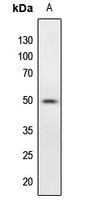 Anti-PTP1B (Phospho-S50) Antibody