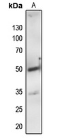 Anti-PTP1B Antibody