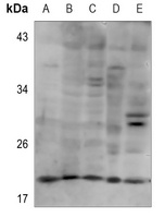 Anti-PXMP2 Antibody