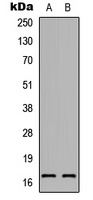 Anti-RAMP1 Antibody
