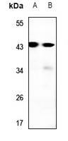 RAD52B antibody