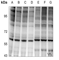 NF-kappaB p65 (phospho-T254) antibody