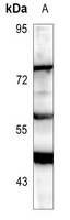 Anti-RIPK3 Antibody