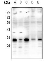 Anti-RNF138 Antibody